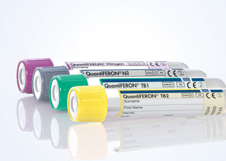 QFT-Plus, QuantiFERON-TB Gold Plus, 622222, 622526, (Spin/Tube/Plate, Photography, MDx)